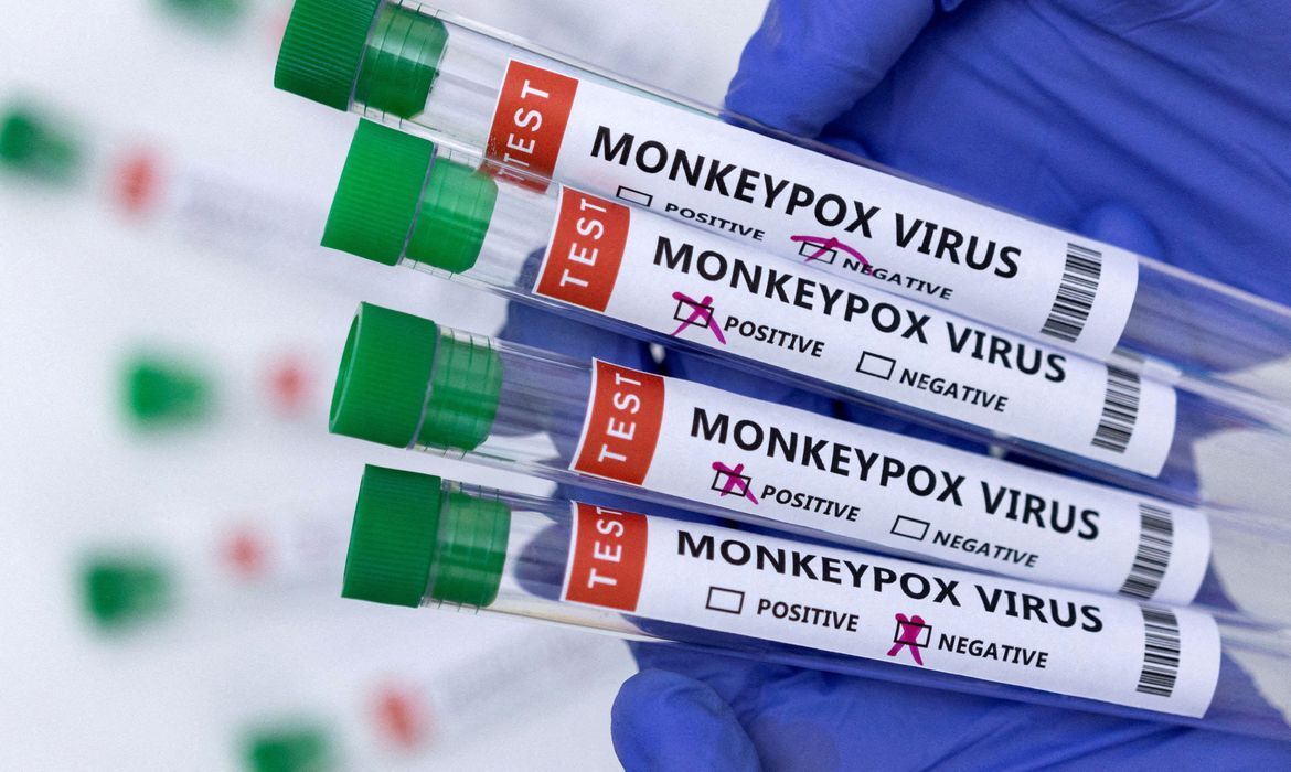 Mpox: após OMS declarar emergência, infectologista explica sintomas e formas de prevenção