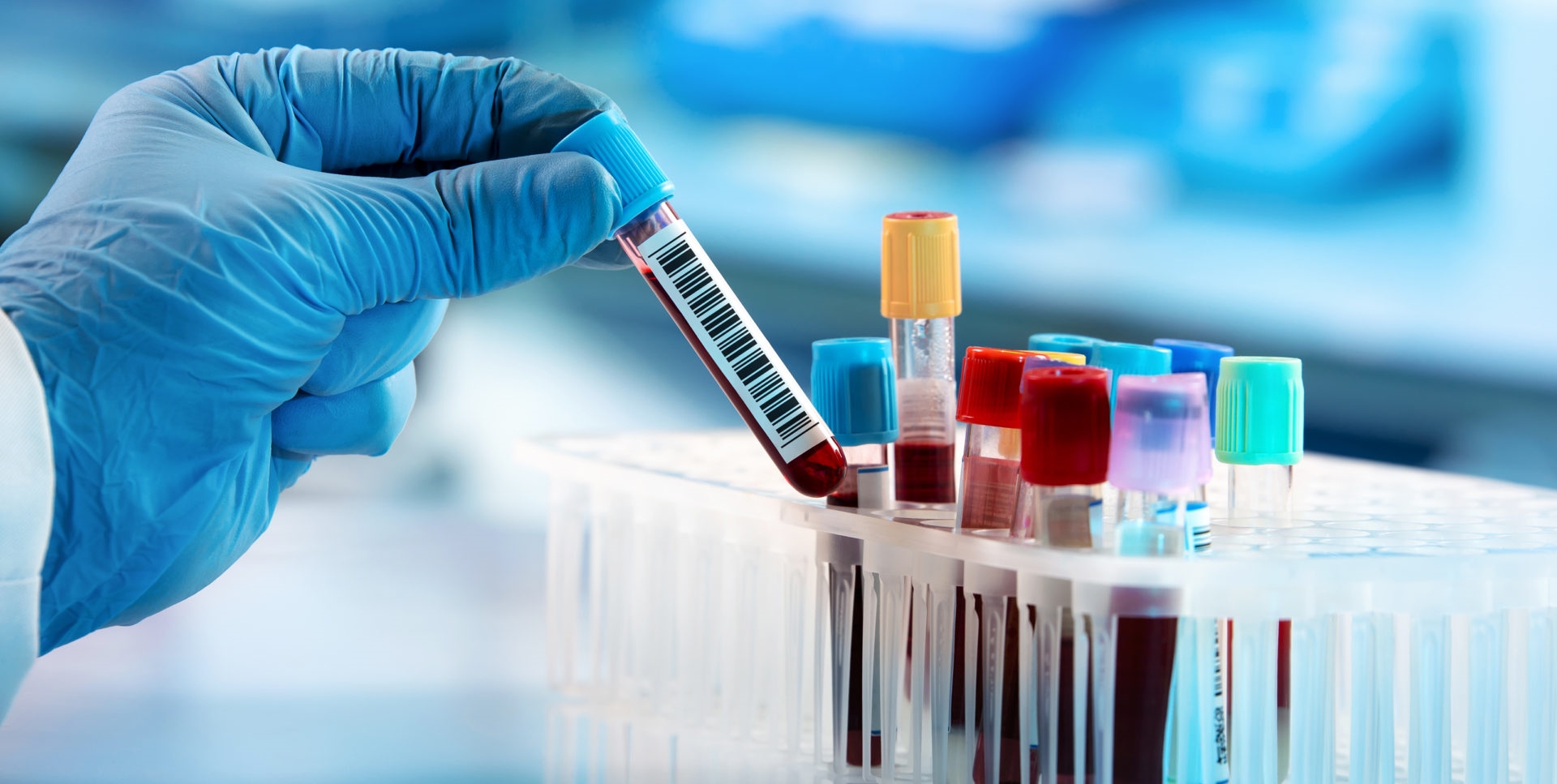 Brasil investiga 64 suspeitas de hepatite misteriosa em crianças e adolescentes