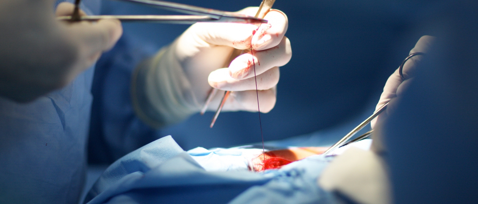 Governador João Azevêdo anuncia campanha para realização de cirurgias de endometriose
