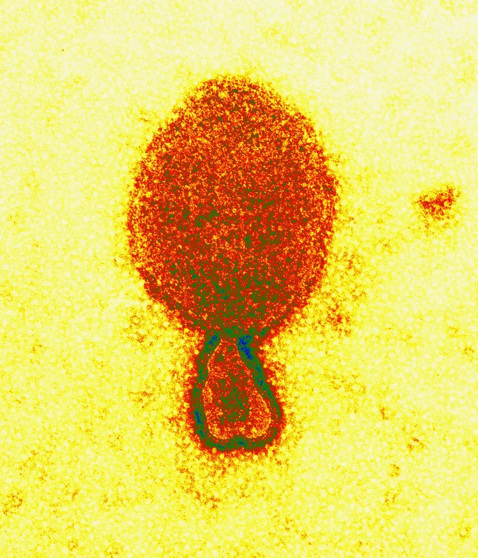 Henipavírus: novo vírus de origem animal infecta 35 pessoas na China, aponta estudo