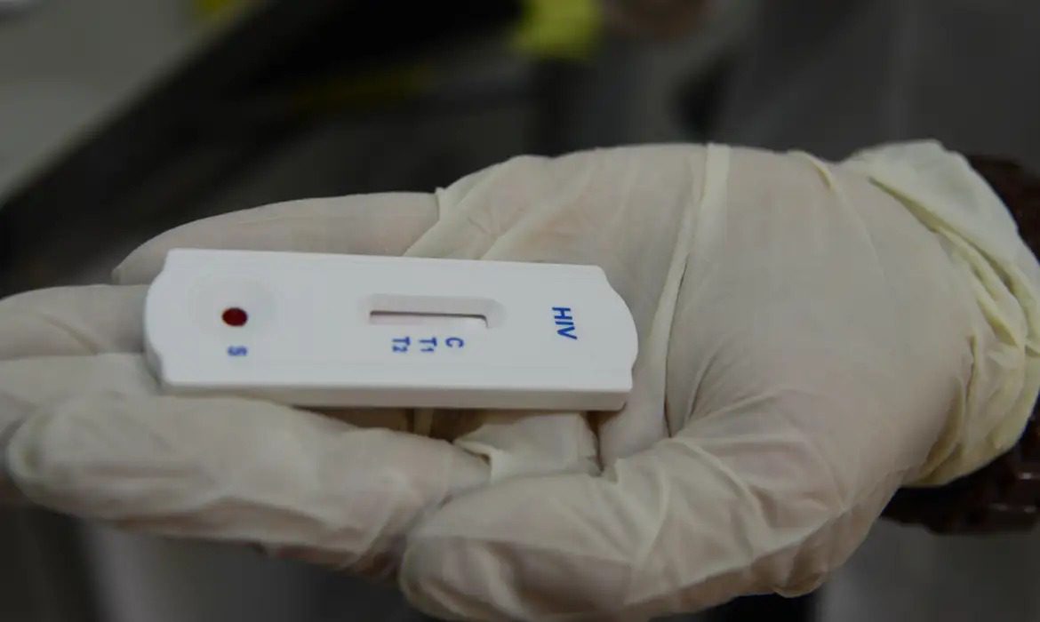 Paraíba registra mais de 780 casos de HIV e Aids entre janeiro e novembro de 2024