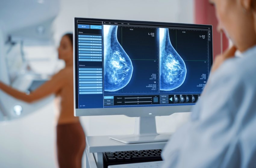  Mulheres temem o câncer, mas subestimam a importância da mamografia 