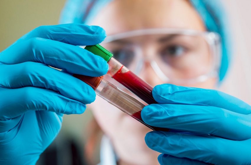  Modernizar o gerenciamento do sangue do paciente é urgente no Brasil 