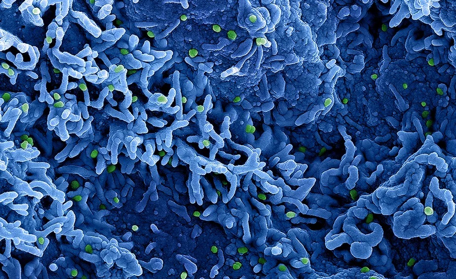 Varíola dos macacos: contato pele com pele durante o sexo é a forma dominante de transmissão da doença, diz estudo