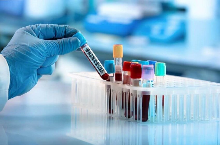  Laboratório da Unimed Cerrado conquista certificação do PNCQ 