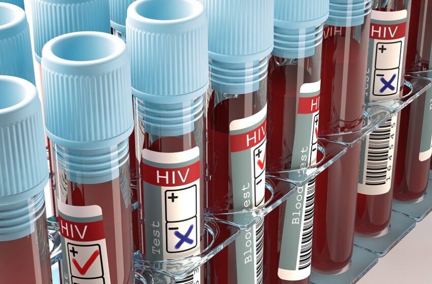  Aids: Brasil tem alta de casos, mas menor mortalidade desde 2013 