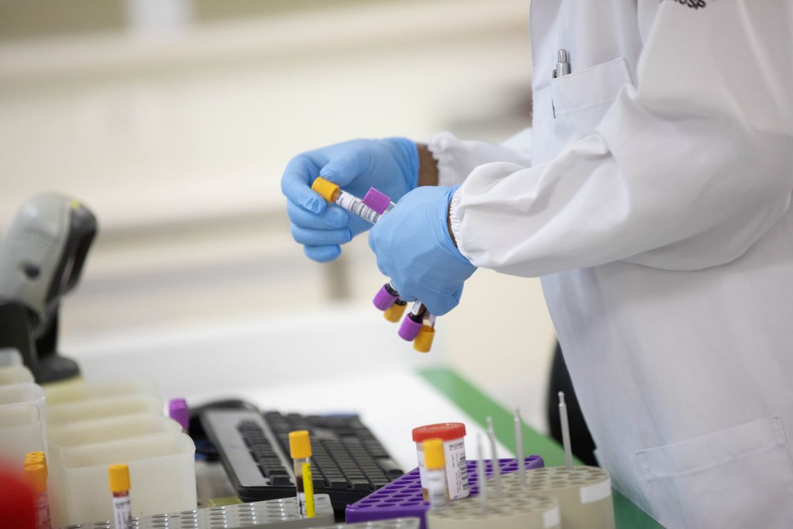 Câncer de intestino se torna mais comum em grupos de pessoas mais jovens