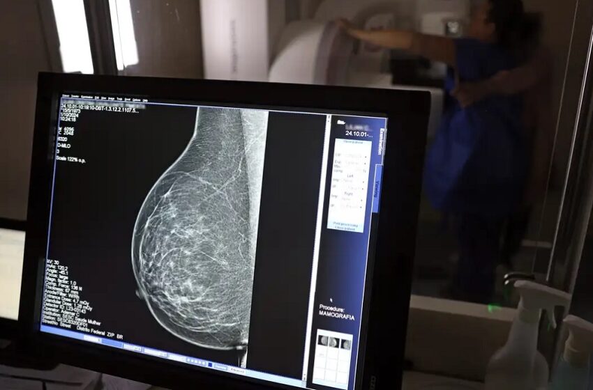  Cerca de 77 mil mulheres aguardam mamografia pelo SUS 