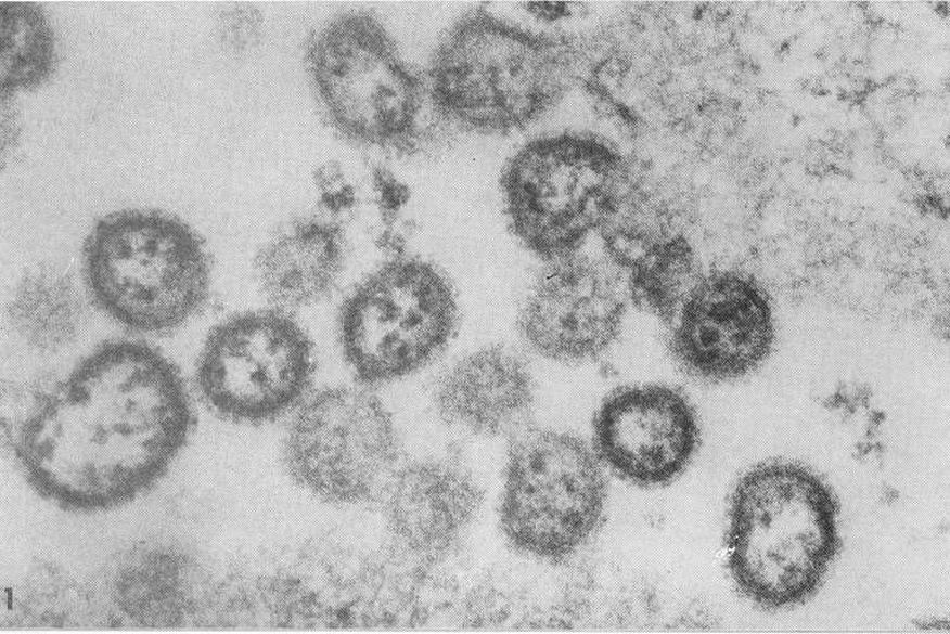 Novo vírus registrado no Brasil causa morte por febre hemorrágica brasileira