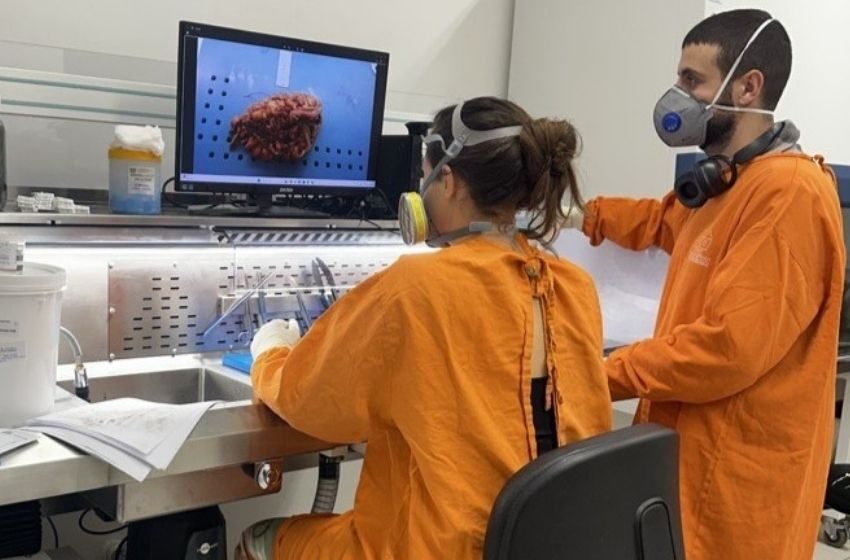  HU-UFSC moderniza Laboratório de Anatomia Patológica 