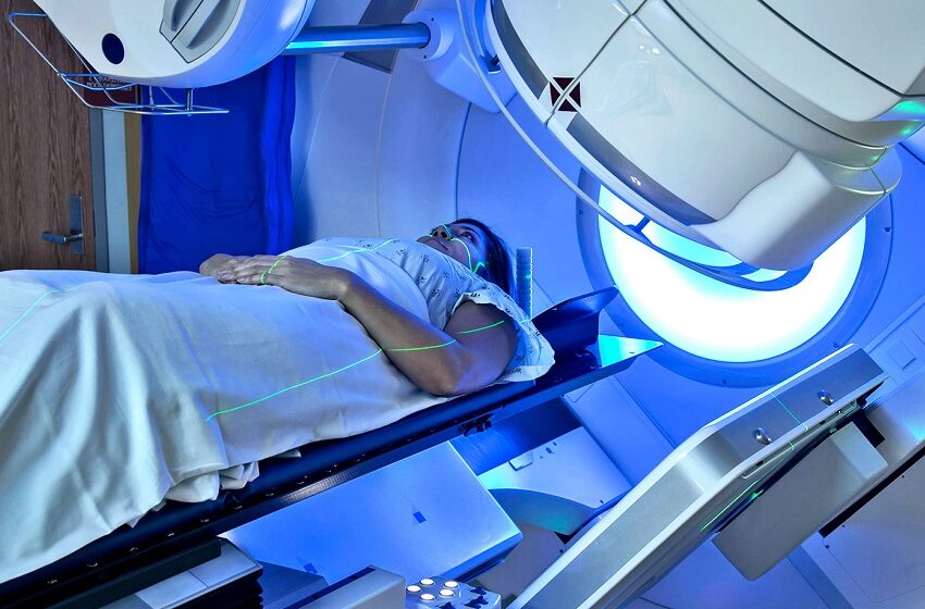  Atraso na radioterapia pode elevar risco de morte em até 29%, alerta SBRT 