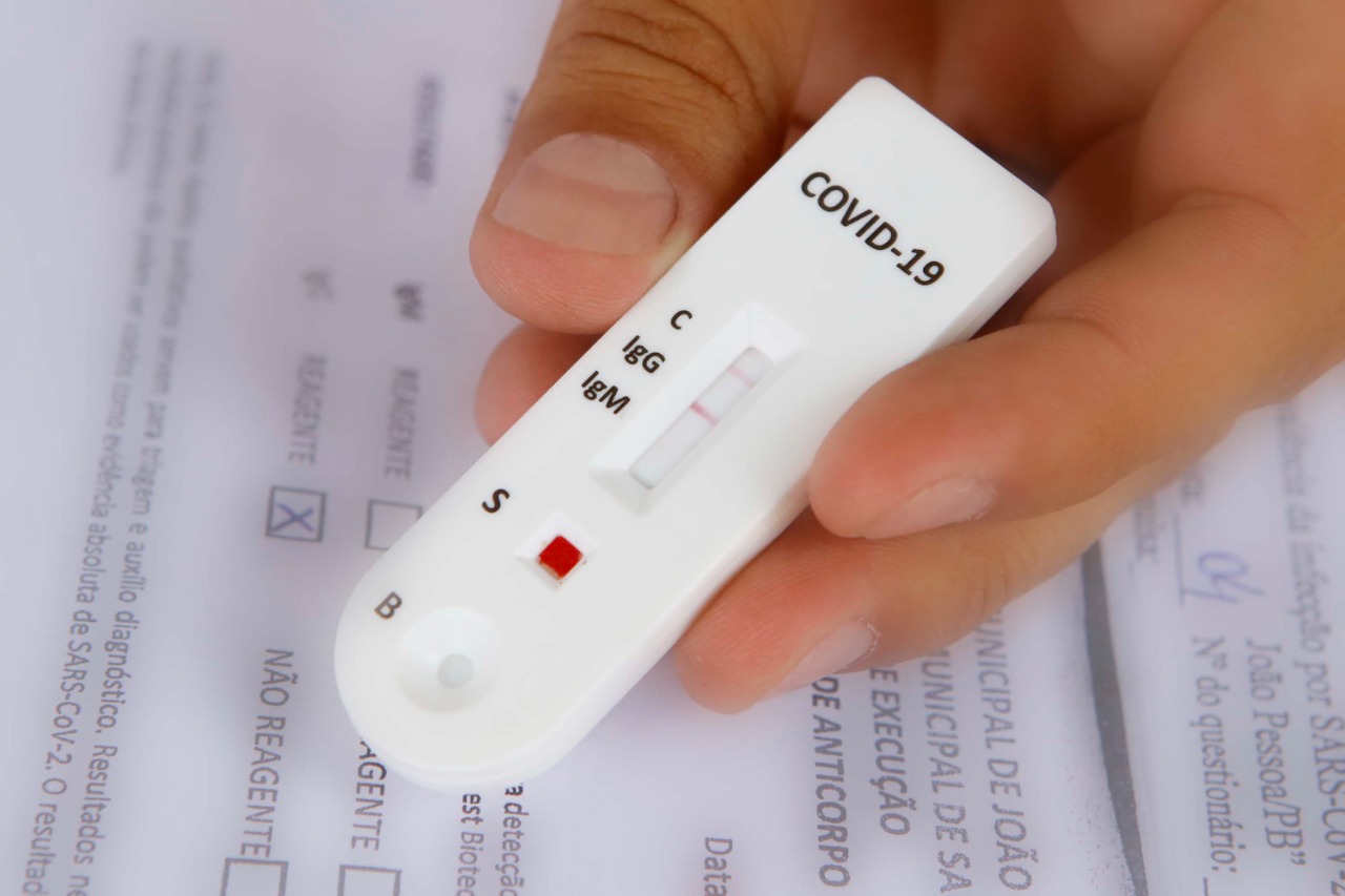 Vigilância Sanitária interdita postos de testagem para Vaquejada em João Pessoa