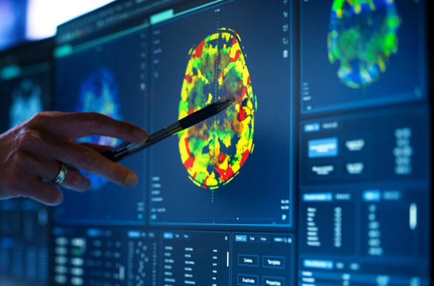  Pesquisadores criam sensor 3D capaz de identificar biomarcadores associados à Parkinson e Alzheimer 