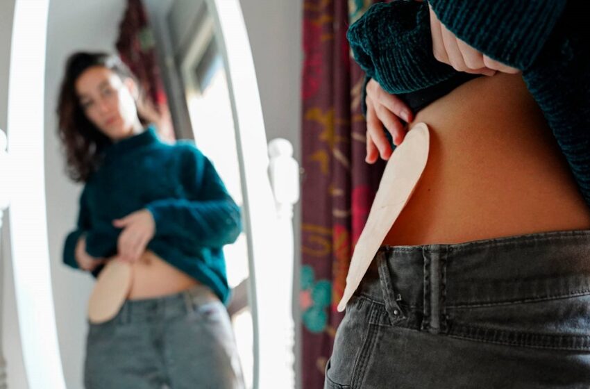  Câmara aprova prazo de 180 dias para reversão de ostomia no SUS 