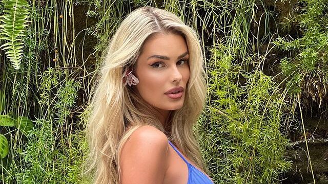 Lipedema, doença de Yasmin Brunet, atinge 12% das brasileiras; veja tratamentos