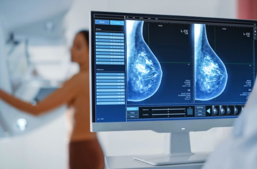  ANS defende que plano cubra mamografia digital sem restrição de idade 