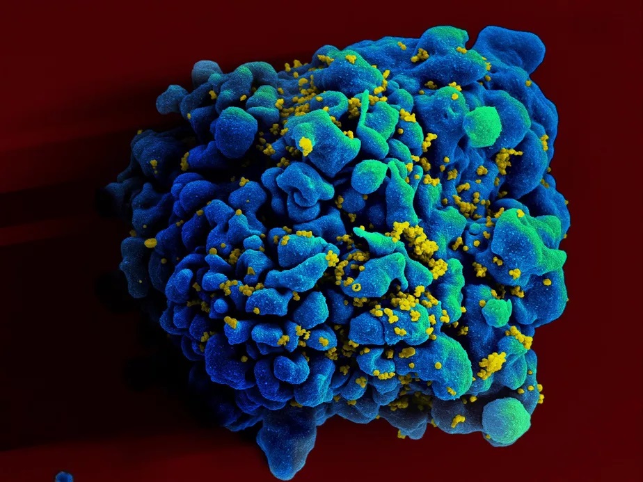 HIV: cientistas anunciam quarto caso de paciente curado