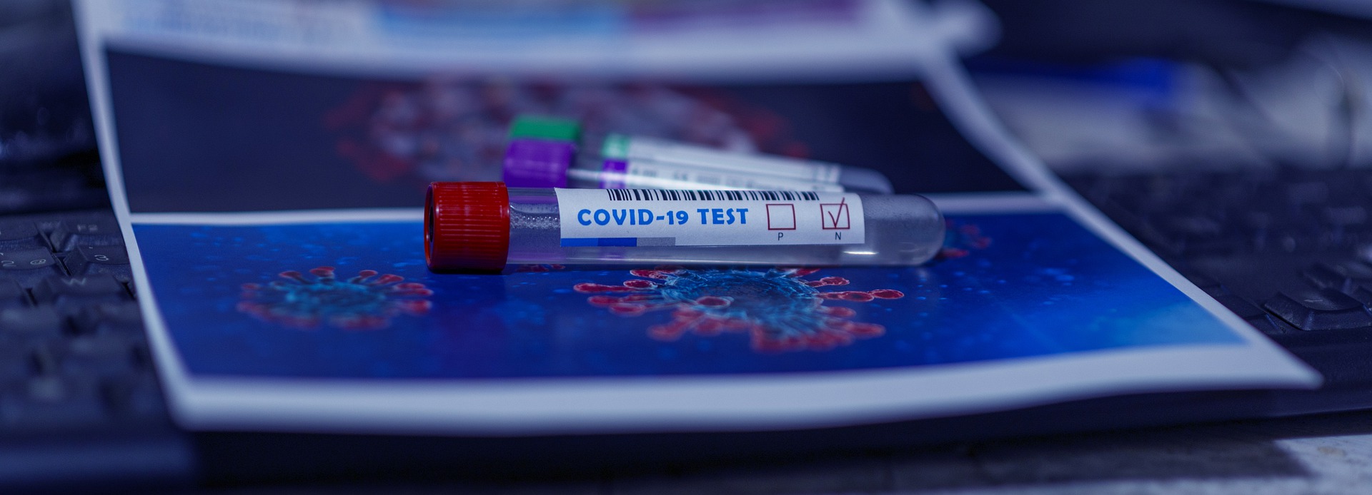 Brasil registra 320 mortes por Covid em 24 h e mais de 10 mil casos