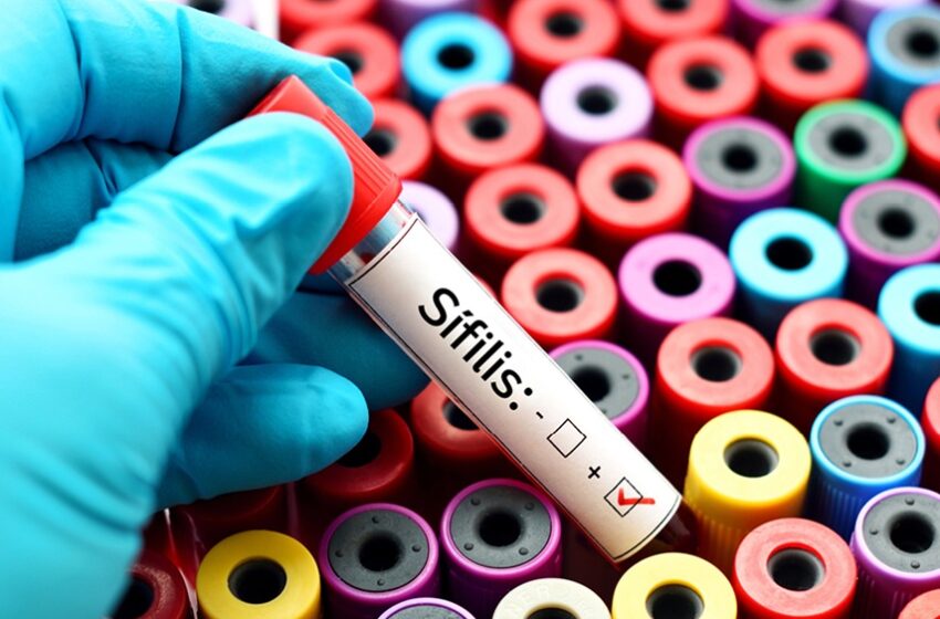  Sífilis continua em ritmo acelerado de crescimento no Brasil 
