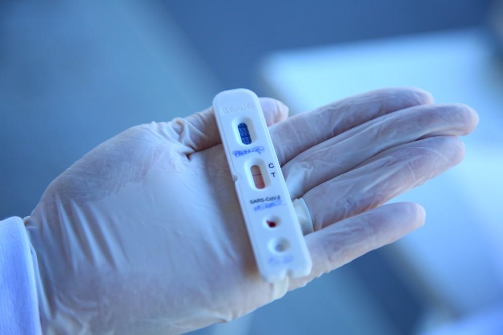 Paraíba registra 7 mortes, 872 novos casos e 24% de ocupação dos leitos Covid-19 nesta quarta-feira