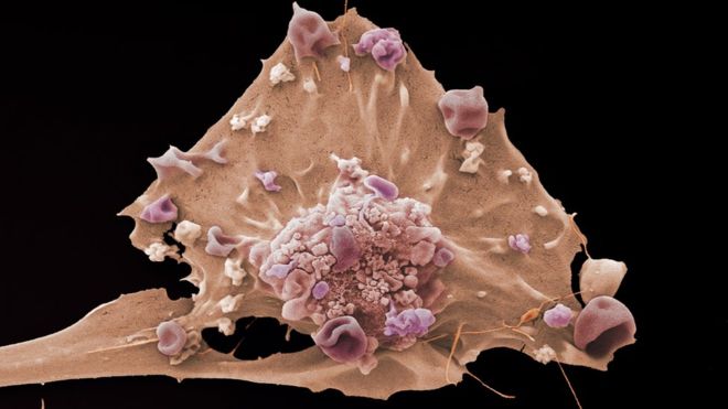 Cientistas planejam criar câncer para pesquisar formas de detectar sinais precoces da doença