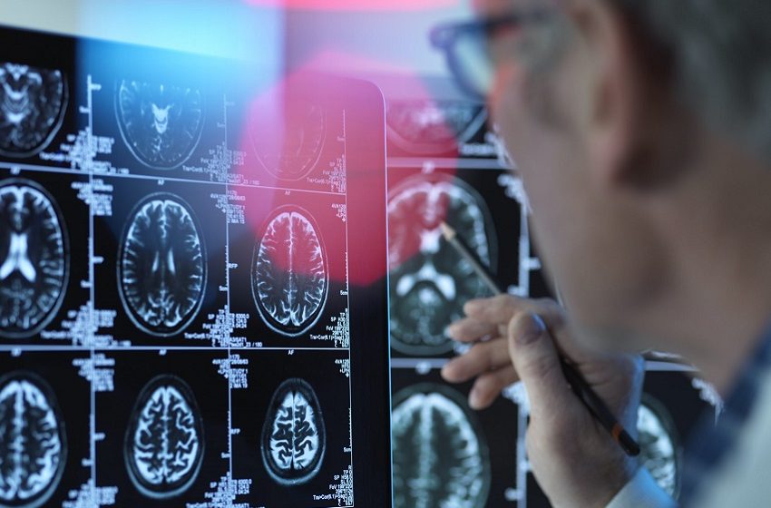  Bactérias na boca e no intestino podem estar relacionadas a aneurismas 