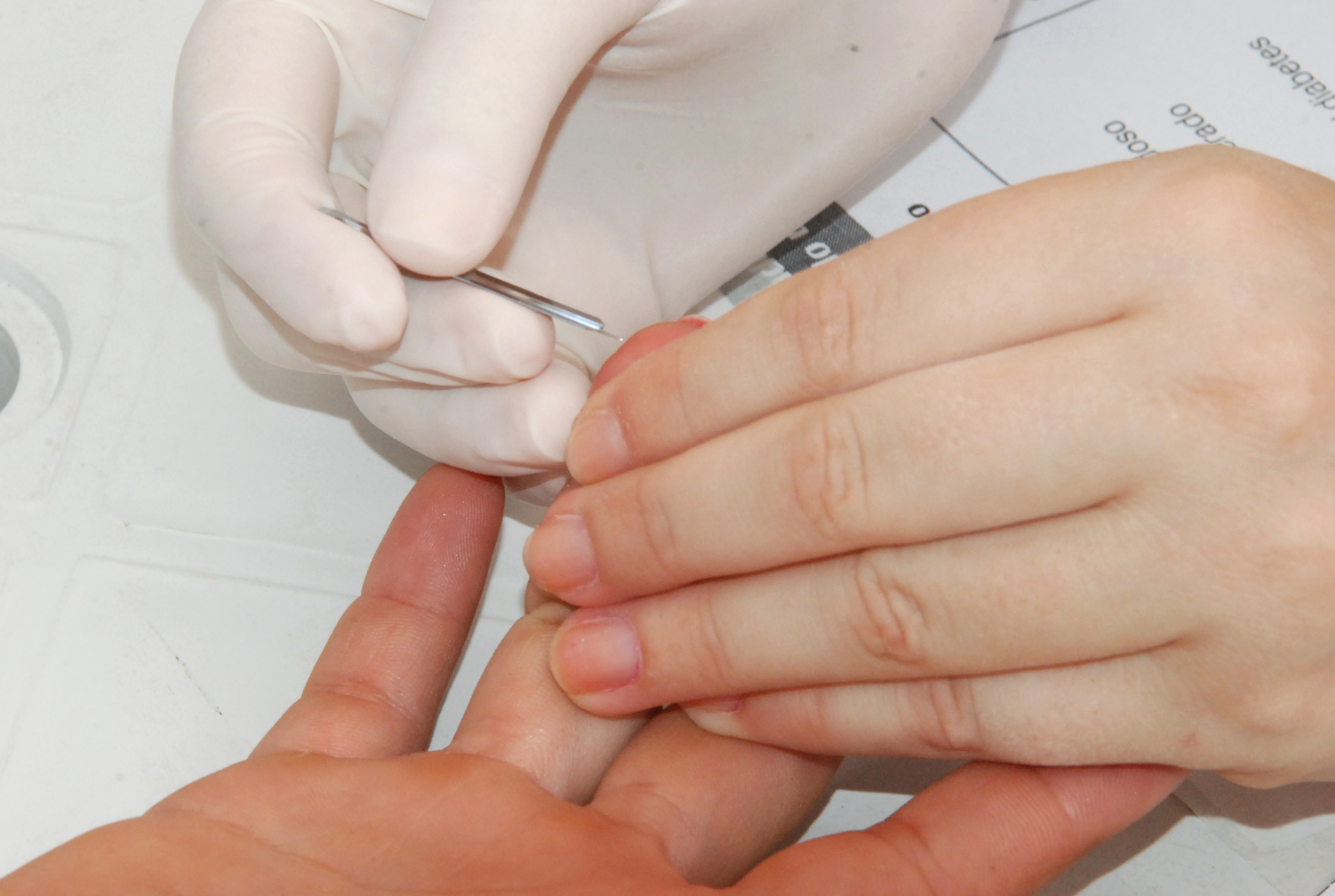 Prefeitura de João Pessoa oferece testes e vacinas contra hepatites virais em ação itinerante nesta sexta-feira