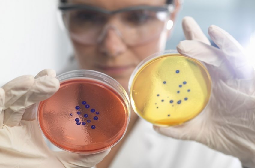  Santa Casa BH inaugura tecnologia avançada com foco em diagnóstico microbiológico 