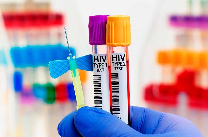  HIV: número de infectados continua abaixo da meta, mas crescem as infecções sexualmente transmissíveis 