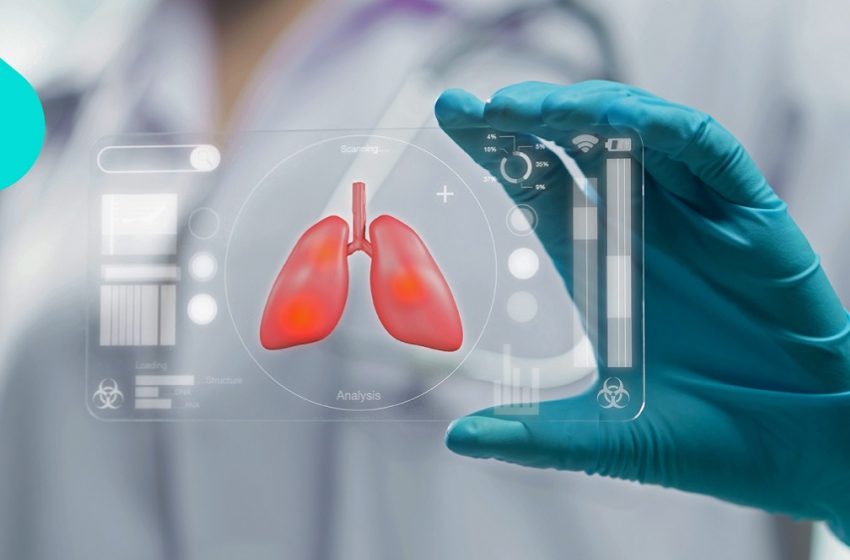  Radioterapia beneficia 60% dos pacientes com câncer de pulmão não operável 