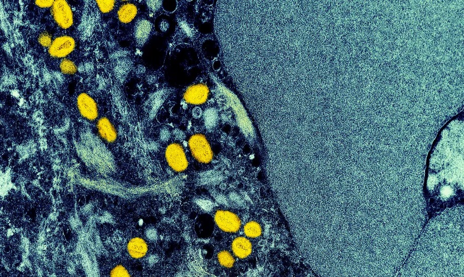 Dois meses após primeiro caso de varíola do macaco, Brasil contabiliza quase 2.300 infectados