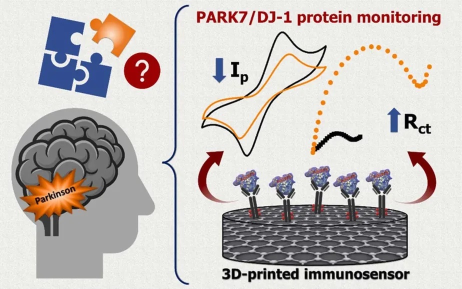Parkinson: cientistas brasileiros desenvolvem sensor barato que identifica doença em estágio inicial
