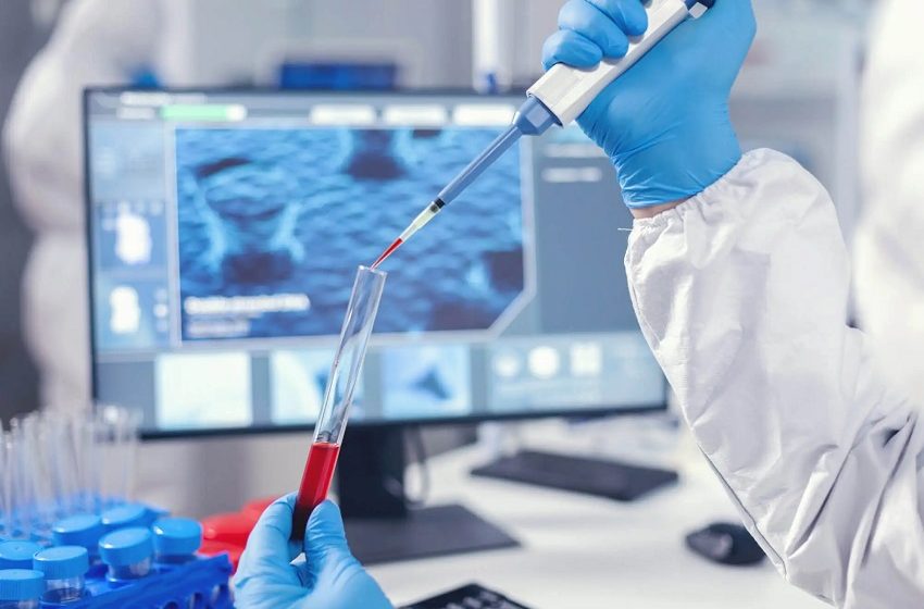  Pesquisa da UFSCar analisa biomarcador para detecção do Alzheimer 